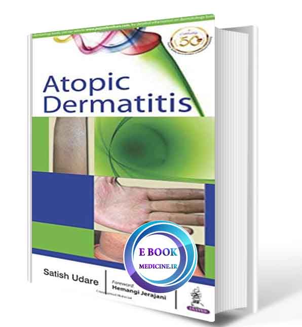 دانلود کتاب Atopic Dermatitis  2018  (ORIGINAL PDF)